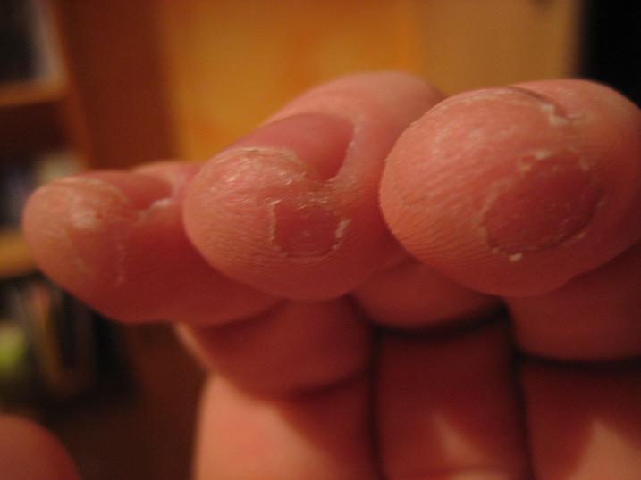 Image:Mirkofingers.jpg