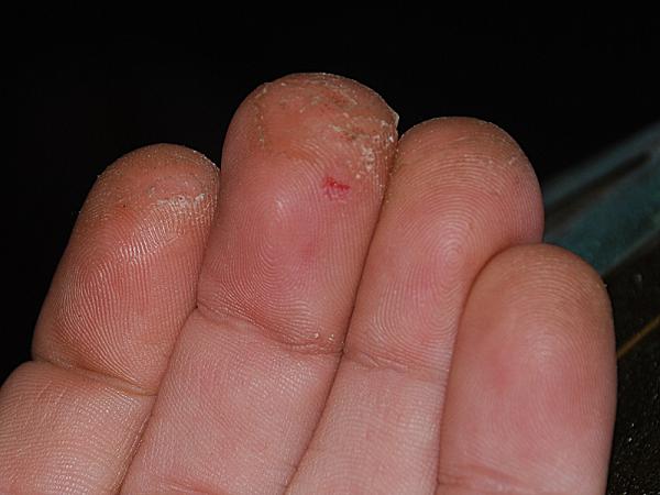 Image:Staffay fingers.jpg